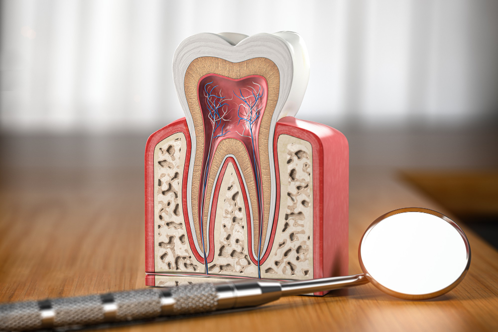 Root Canals  Covington, LA